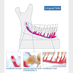 Mandibular Nervemodel